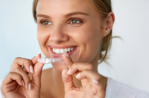 Invisalign